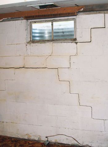 severe bowing and buckling of foundation walls in Easton